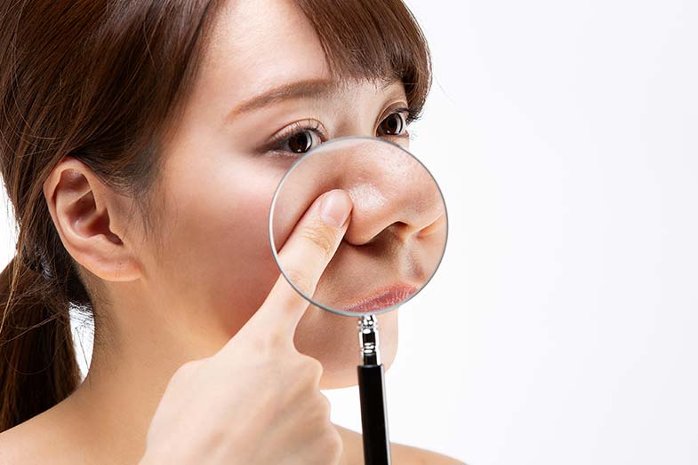 いちご鼻の原因と効果的な治し方を解説！レーザー治療がおすすめ！