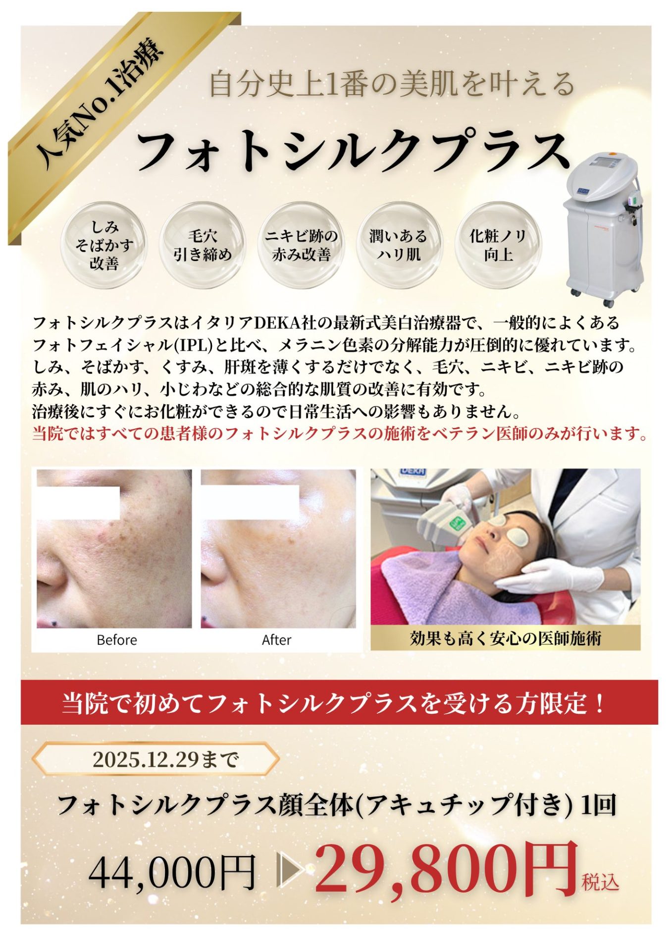 フォトシルクキャンペーン