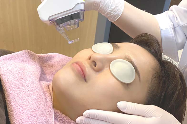 当院で使用している『フラクショナルCO2レーザー』の特徴