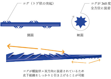 コグが螺旋状+双方向に装着されているため皮下組織をしっかりと引き上げることが可能